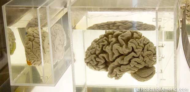 Brain display.