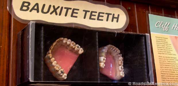 Bauxite Teeth display.