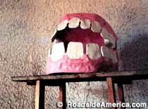 Bedrock City teeth.