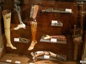 Display of prosthetic limbs.