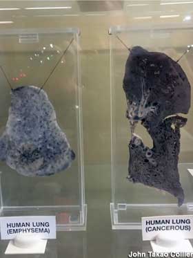 Lung slices on display.