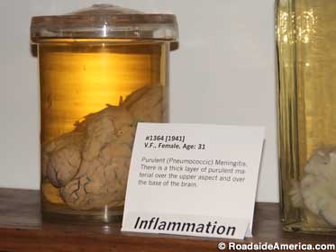 This particular brain has been pickled since 1941.