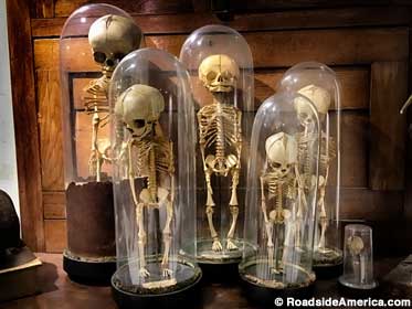 Fetal skeletons under glass.