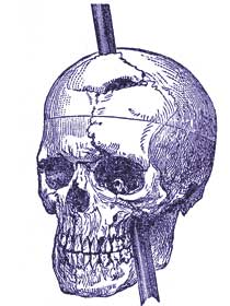 Drawing shows the rod through Gage's skull.