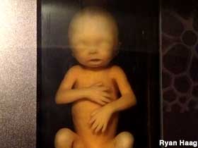 Fetus display.