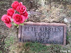Pete Kibble's Foot - 1917.