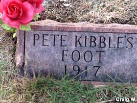 Pete Kibble's Foot - 1917.