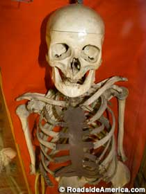 Skeleton of Jeff Davis.