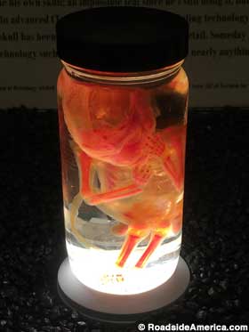 Fetus in a jar, 