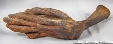 >Mummified Human Arm.